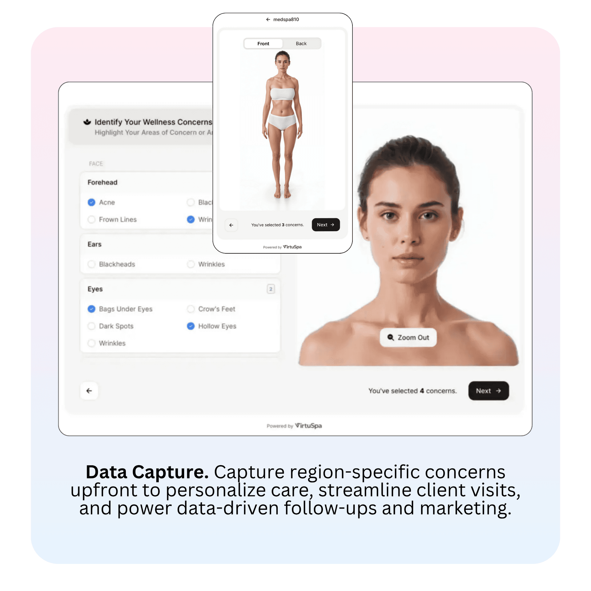 Client Conversion Interface